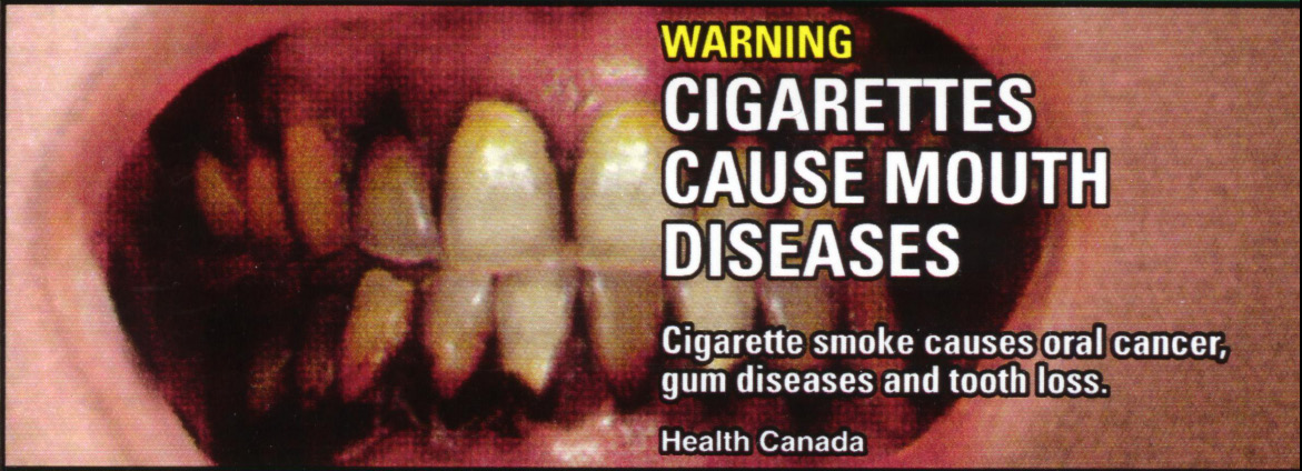 Can 2000 Health Effects mouth - mouth diseased, gross